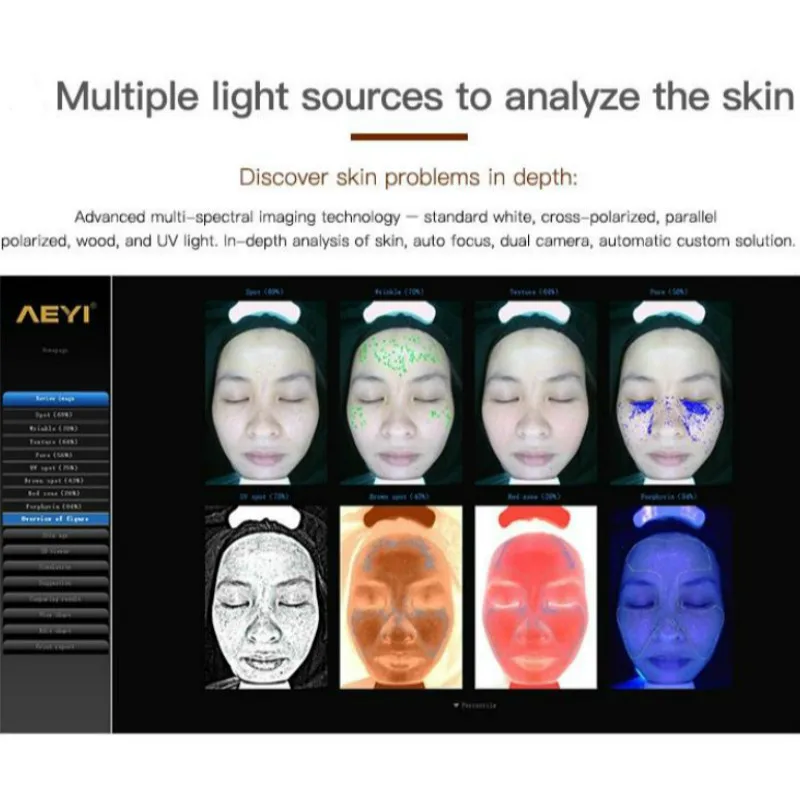 Atest Преносим UV + Rgb + Pl Светлинна Система за Анализ на Лицето Скенер 3D Анализатор на Кожата на Лицето Магическо Огледало Visia Машина За Анализ на Кожата 5